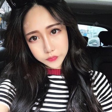张昵 医生