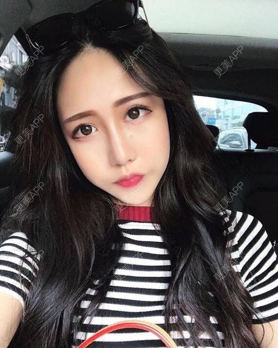 更美 - 张昵 医生的眼部修复经验 | 眼部修复 | 广州