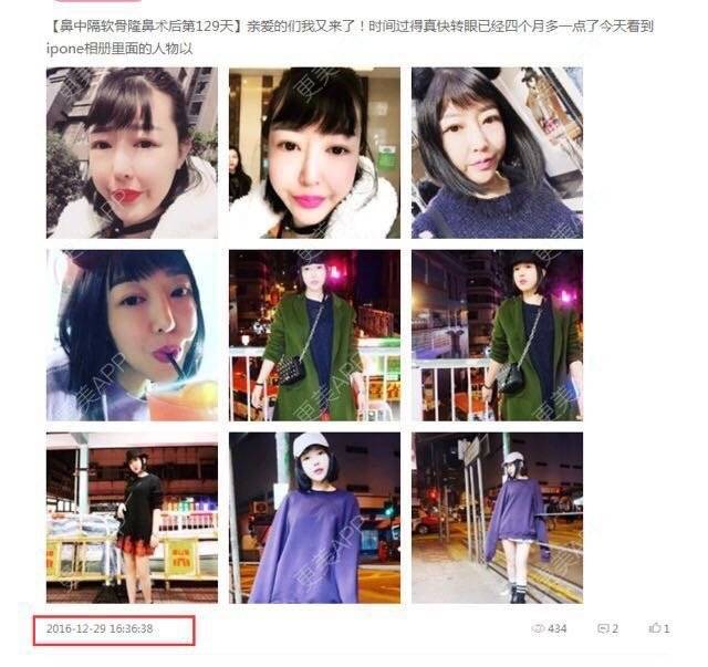 更美 - 重庆天艺美整形的经验