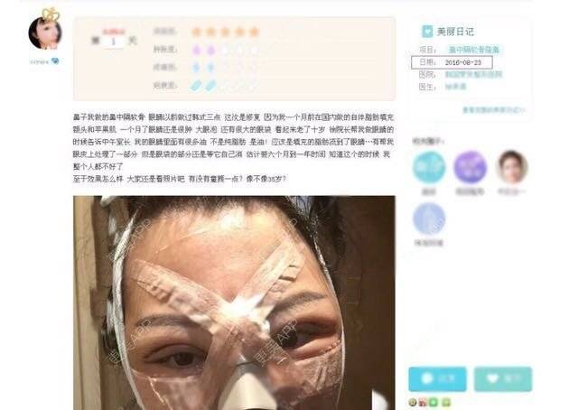 更美 - 重庆天艺美整形的经验