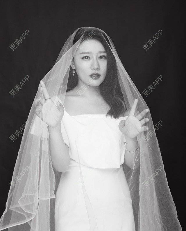 更美 - 武汉美莱医疗美容医院的全切双眼皮经验 | 全切双眼皮 | 武汉