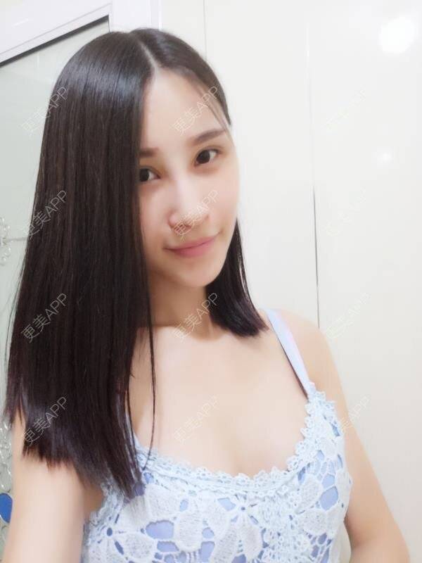 01我不开心01的自体脂肪隆胸日记