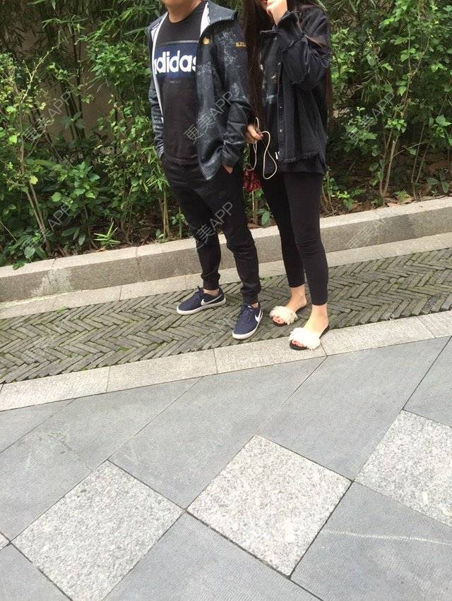 更美 - 慢漫曼小姐的吸脂瘦大腿经验 | 宁波 | 吸脂瘦大腿