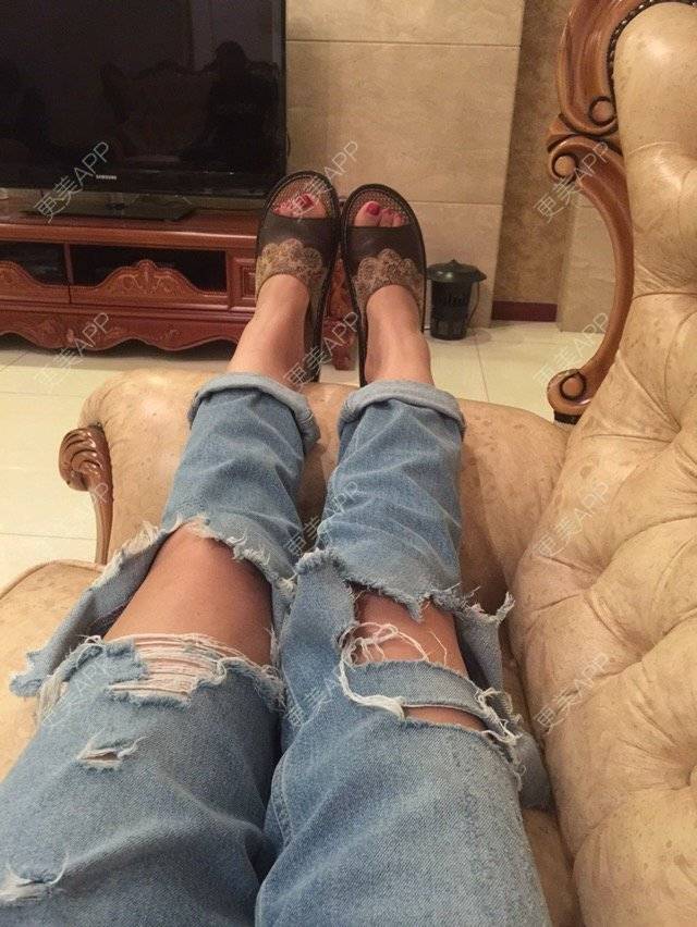 更美 - 慢漫曼小姐的吸脂瘦大腿经验 | 宁波 | 吸脂瘦大腿