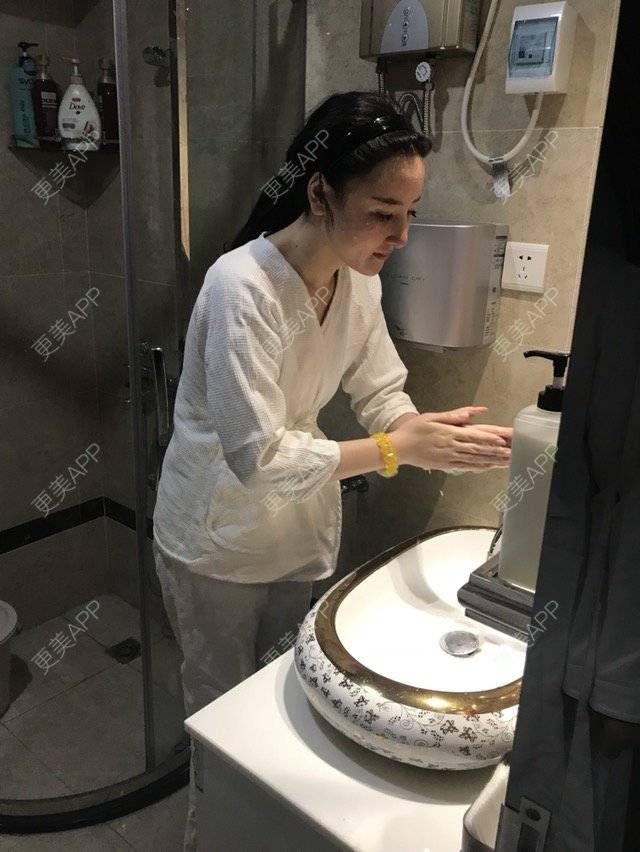 更美 - miss 苏的鼻部膨体假体取出经验 | 鼻部膨体假体取出 | 鼻骨内推 | 深圳 | 鼻部整形