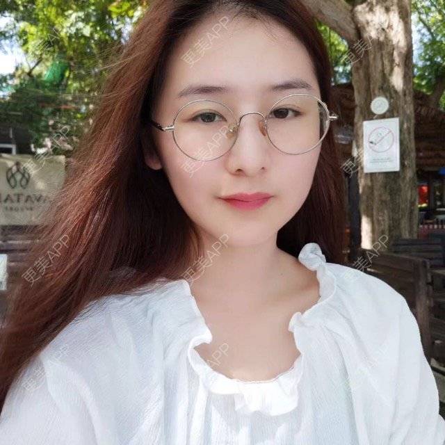 更美 - 请叫我雅雅的埋线提升经验 | 成都 | 埋线提升 | 自体脂肪填充全面部 | 自体脂肪填充面颊