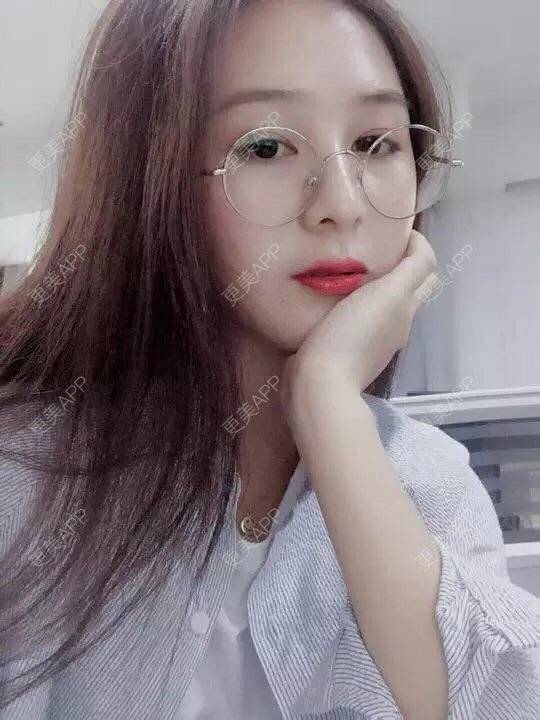 更美 - 请叫我雅雅的埋线提升经验 | 成都 | 埋线提升 | 自体脂肪填充全面部 | 自体脂肪填充面颊