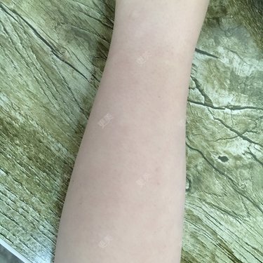 王用洪 医生