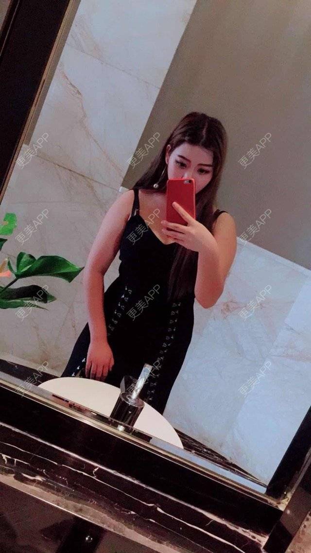 更美 - 更美用户uhjgJzL3xQ的吸脂瘦大腿经验 | 手臂吸脂 | 吸脂手术 | 吸脂瘦大腿 | 广州