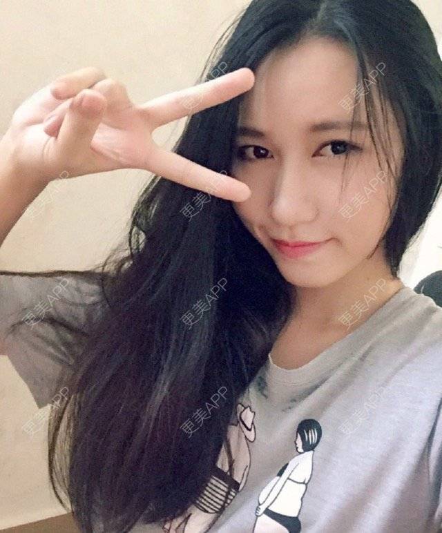 更美 - 失眠的kiki的冷光美白经验 | 冷光美白 | 广州