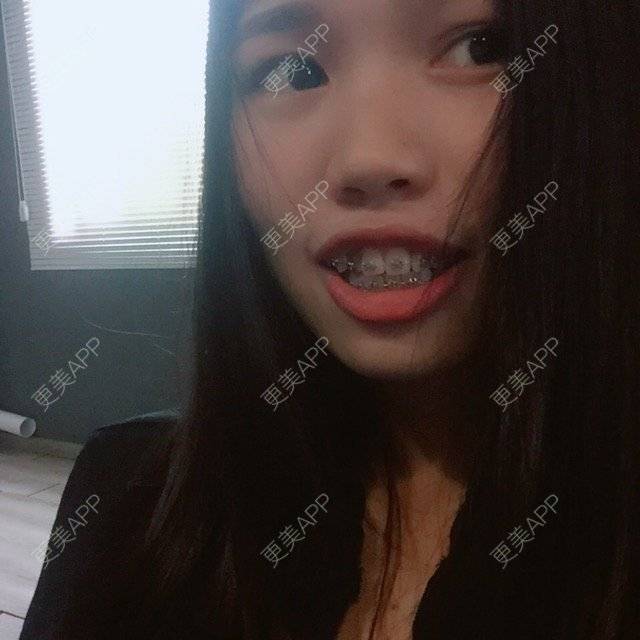 更美 - 妮可酱的经验 | 广州