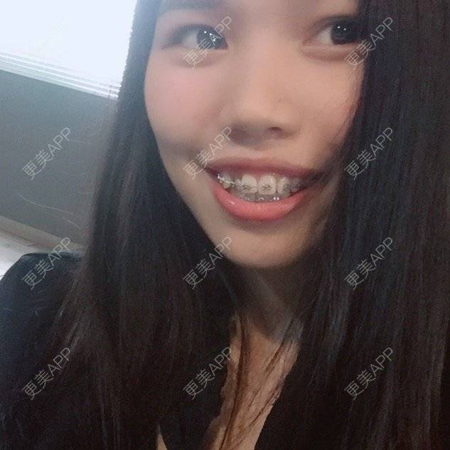更美 - 妮可酱的经验 | 广州