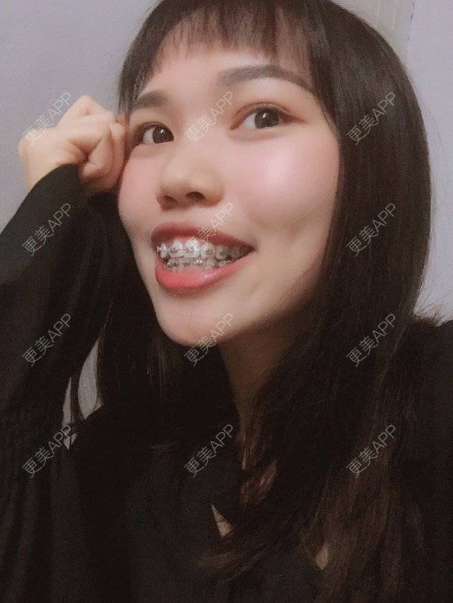 更美 - 妮可酱的经验 | 广州