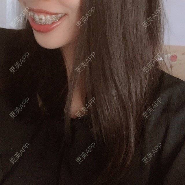 更美 - 妮可酱的经验 | 广州