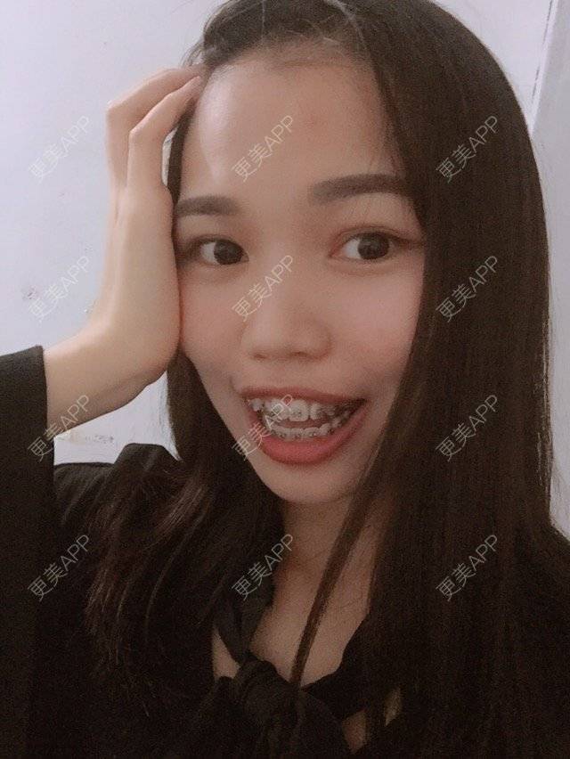更美 - 妮可酱的经验 | 广州