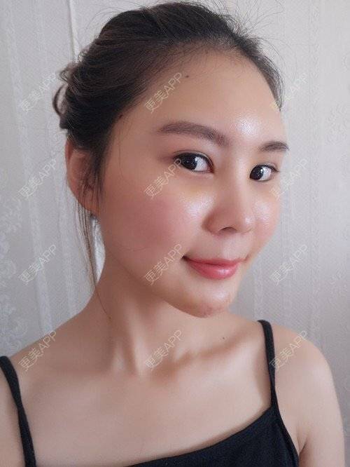 更美 - 赖炳招 医生的经验 | 厦门