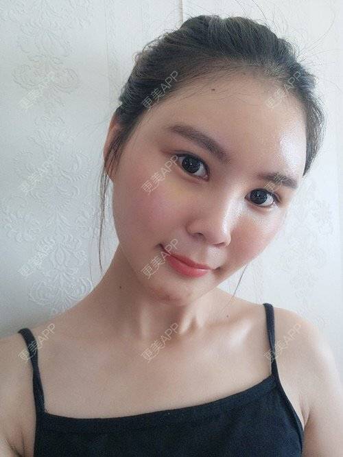 更美 - 赖炳招 医生的经验 | 厦门