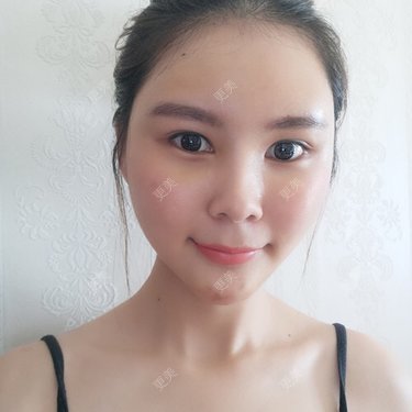 赖炳招 医生