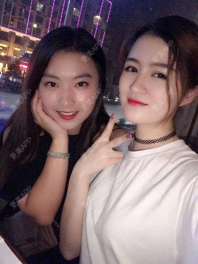 更美 - Coco26的除皱瘦脸经验 | 广州 | 打瘦脸针 | 注射瘦脸针 | 除皱瘦脸