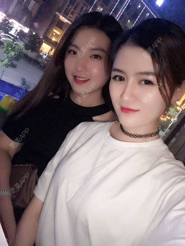 更美 - Coco26的除皱瘦脸经验 | 广州 | 打瘦脸针 | 注射瘦脸针 | 除皱瘦脸