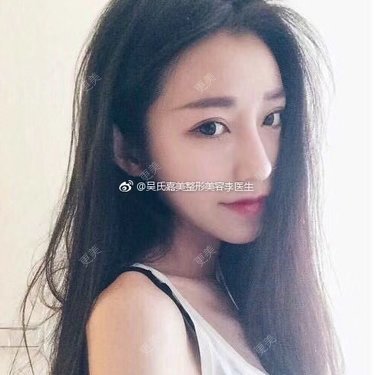 李明 医生