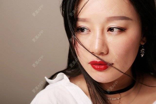 更美 - 武汉美莱医疗美容医院的全切双眼皮经验 | 全切双眼皮 | 武汉