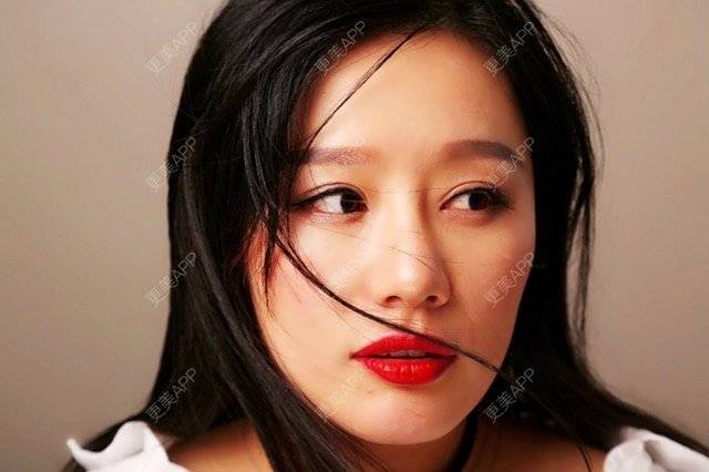 更美 - 武汉美莱医疗美容医院的全切双眼皮经验 | 全切双眼皮 | 武汉