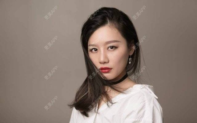 更美 - 武汉美莱医疗美容医院的全切双眼皮经验 | 全切双眼皮 | 武汉
