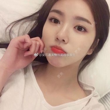 李明 医生