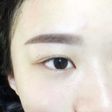 李明 医生