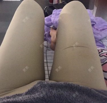 朱渺 医生