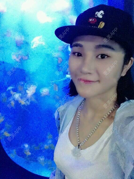 更美 - 潘俊良 医生的膨体隆鼻经验 | 膨体隆鼻 | 重庆