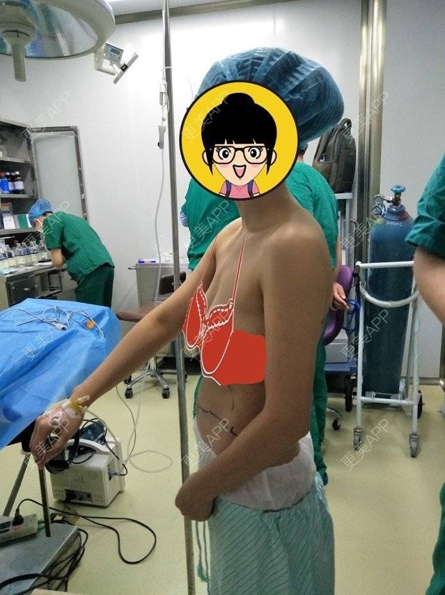 更美 - 杉杉来吃S的腰腹吸脂经验 | 侧腰吸脂 | 腰腹吸脂 | 深圳同城 | 深圳