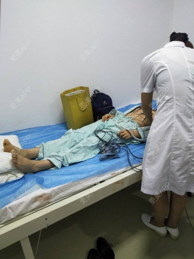 更美 - 杉杉来吃S的腰腹吸脂经验 | 侧腰吸脂 | 腰腹吸脂 | 深圳同城 | 深圳