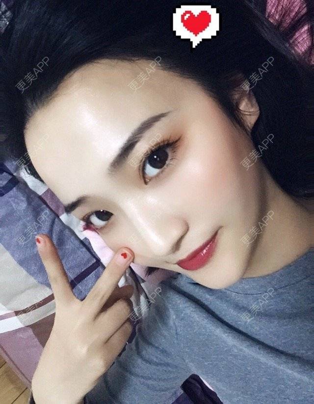 宁小倩倩的双眼皮日记