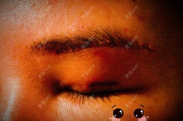切眉纹眉_切眉后纹眉效果图片_文眉切眉