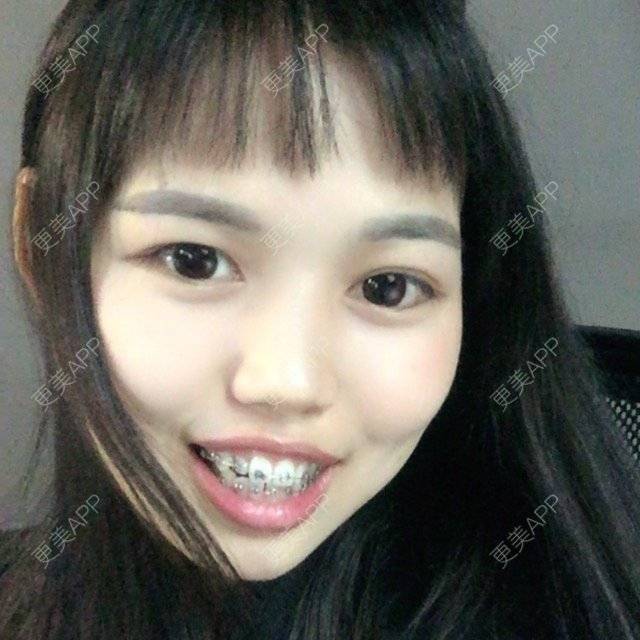 更美 - 妮可酱的经验 | 广州