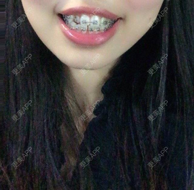 更美 - 妮可酱的经验 | 广州