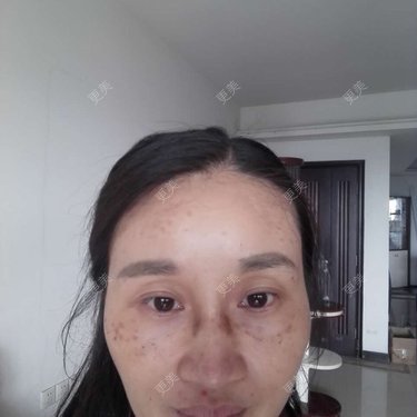 更美用户M0GeHCOhRS