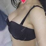 更美 - 郝永生 医生的假体隆胸经验 | 假体隆胸