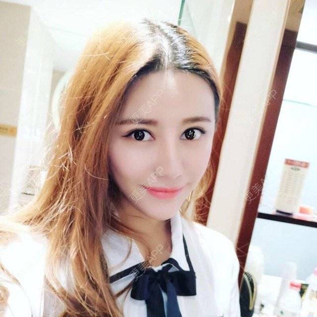 更美 - 柠檬苏打水的经验 | 成都 | 视频日记 | 鼻综合手术 | 鼻综合小翘鼻 | 想做鼻子