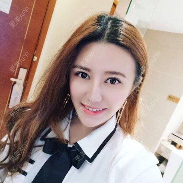 更美 - 柠檬苏打水的经验 | 成都 | 视频日记 | 鼻综合手术 | 鼻综合小翘鼻 | 想做鼻子