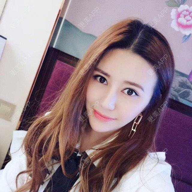 更美 - 柠檬苏打水的经验 | 成都 | 视频日记 | 鼻综合手术 | 鼻综合小翘鼻 | 想做鼻子