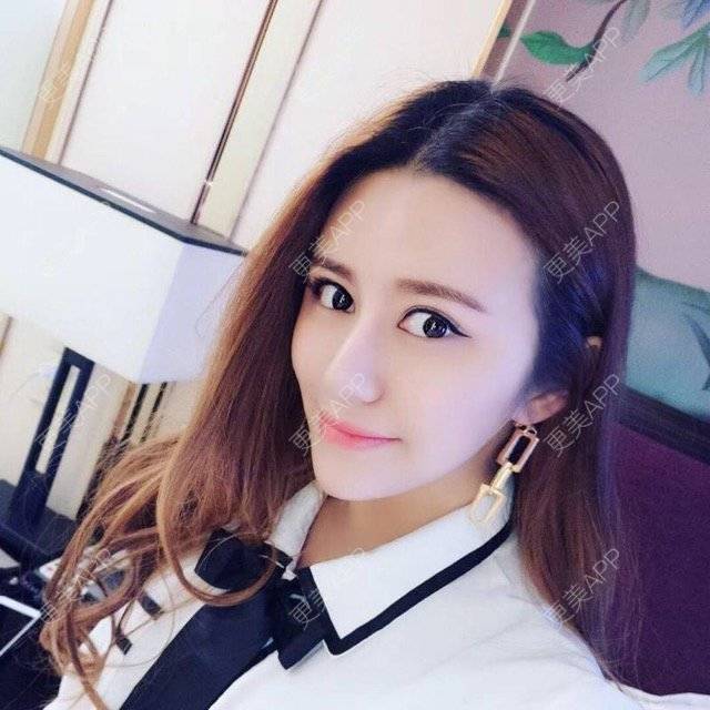 更美 - 柠檬苏打水的经验 | 成都 | 视频日记 | 鼻综合手术 | 鼻综合小翘鼻 | 想做鼻子
