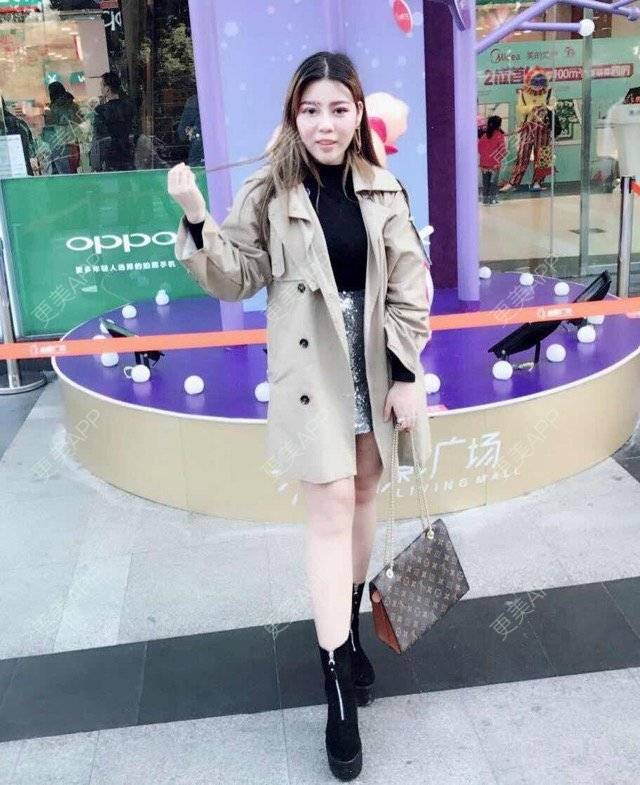 更美 - 更美用户uhjgJzL3xQ的吸脂瘦大腿经验 | 手臂吸脂 | 广州 | 吸脂手术 | 吸脂瘦大腿