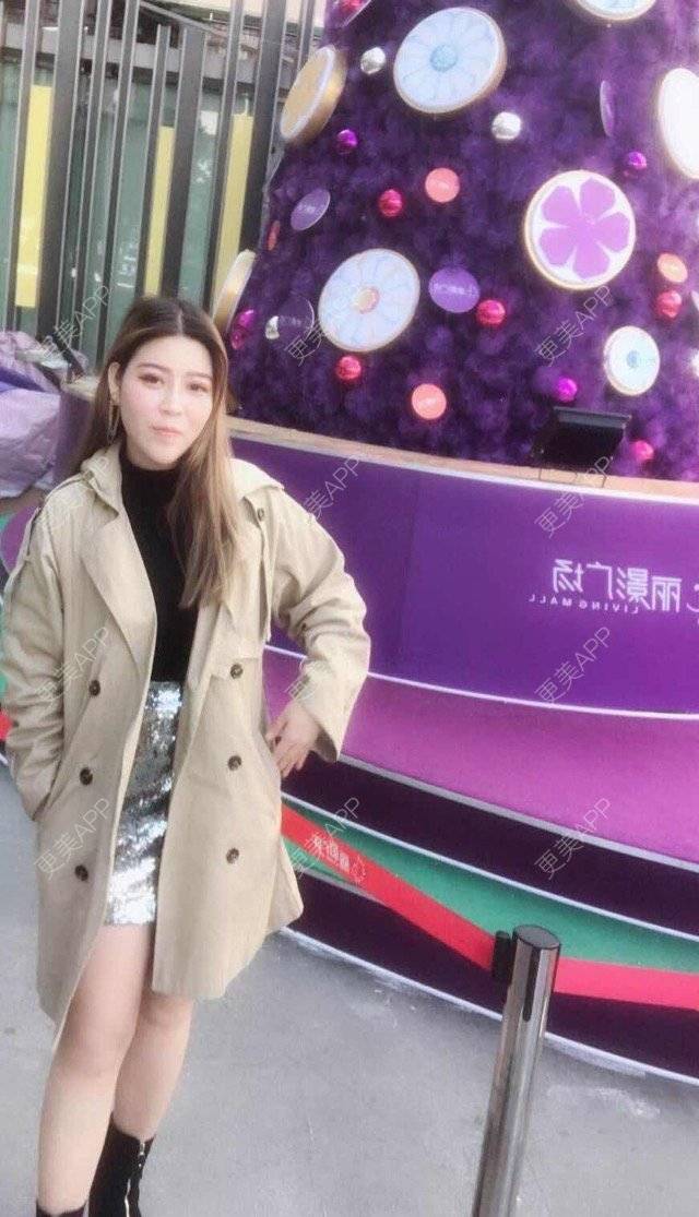 更美 - 更美用户uhjgJzL3xQ的吸脂瘦大腿经验 | 手臂吸脂 | 广州 | 吸脂手术 | 吸脂瘦大腿