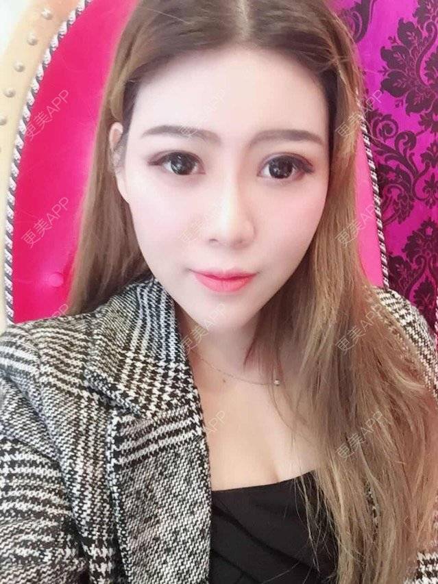 更美 - 更美用户uhjgJzL3xQ的吸脂瘦大腿经验 | 手臂吸脂 | 广州 | 吸脂手术 | 吸脂瘦大腿