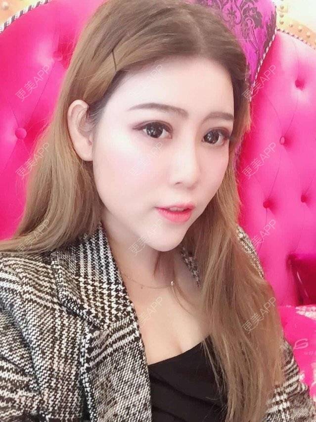 更美 - 更美用户uhjgJzL3xQ的吸脂瘦大腿经验 | 手臂吸脂 | 广州 | 吸脂手术 | 吸脂瘦大腿