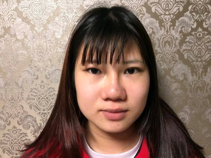 八大处医院唐勇怎么样?吸脂瘦脸预约方式-价格表