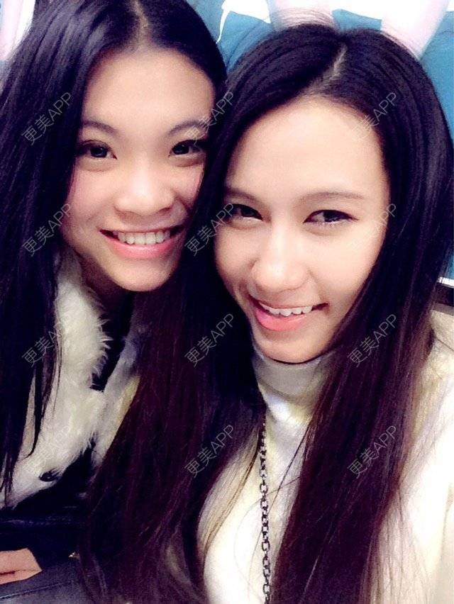 更美 - 失眠的kiki的冷光美白经验 | 广州 | 冷光美白